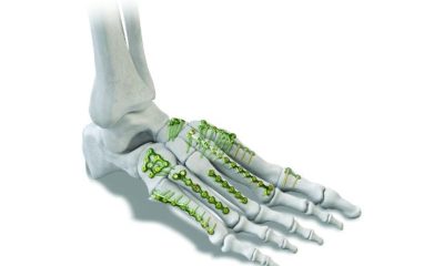 Executive Recruiting Trends in the Orthopedic Devices Industry What to Expect in the Next Decade